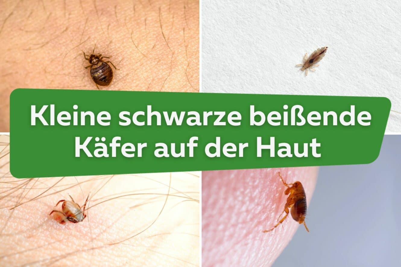 Kleine Schwarze Bei Ende K Fer Auf Der Haut